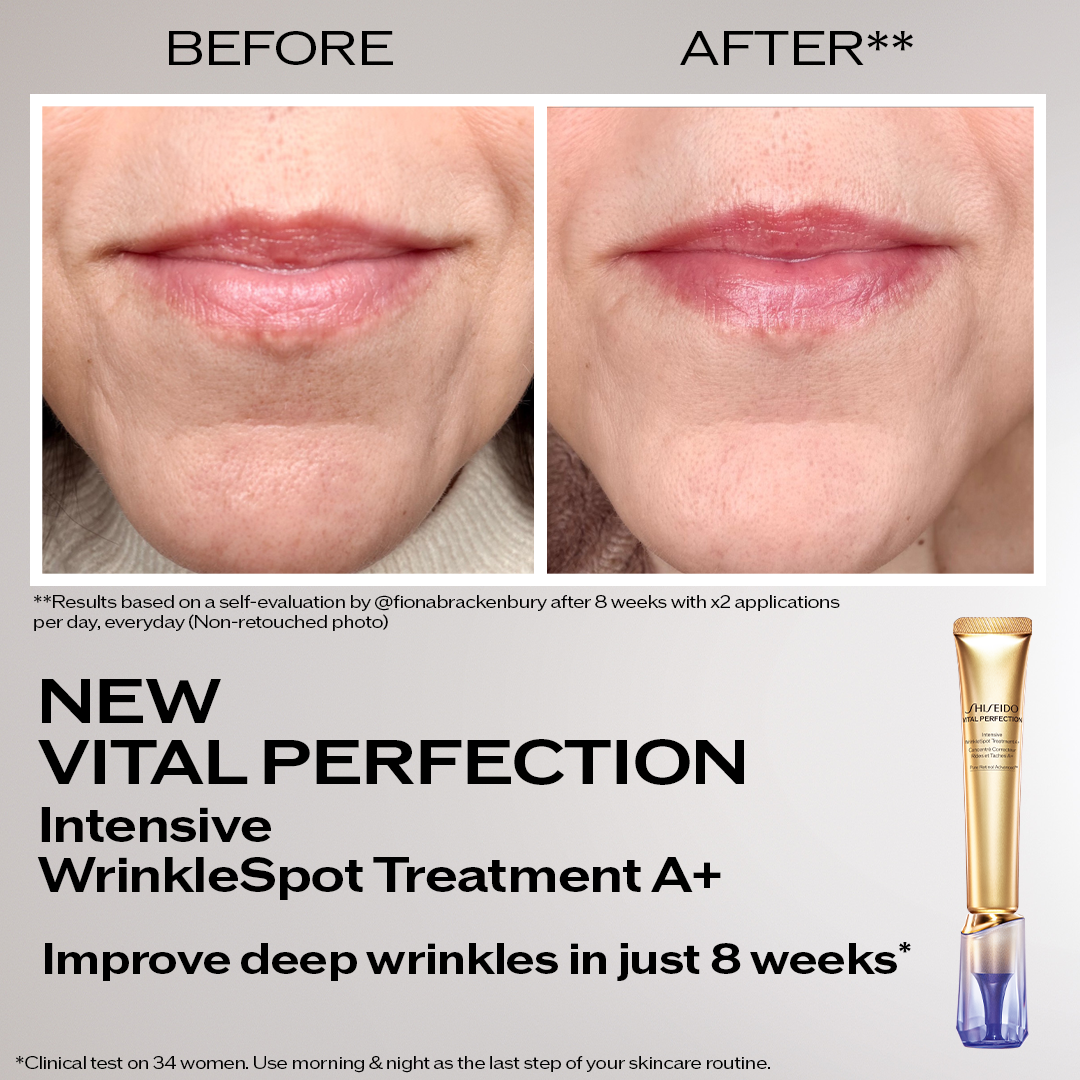 Intensive WrinkleSpot Treatment 20mL for Youthful Skin | SHISEIDO